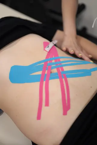 Кінезіотейпування попереку — фахівець PainRelieF накладає рожеві та сині кінезіотейпи на нижню частину спини клієнта